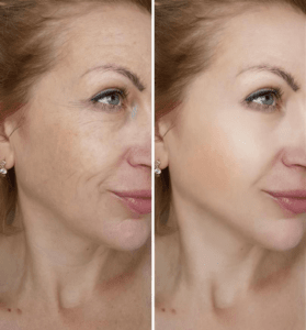 Derma Prime Plus - Customer Happy